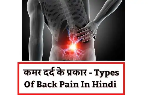 Back pain types | कमर दर्द के प्रकार | Types Of Back Pain In Hindi