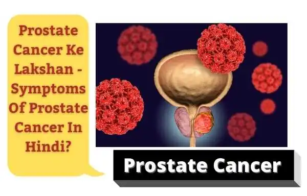 Prostate Cancer Kaise Hota Hai | Causes Of Prostate Cancer In Hindi?