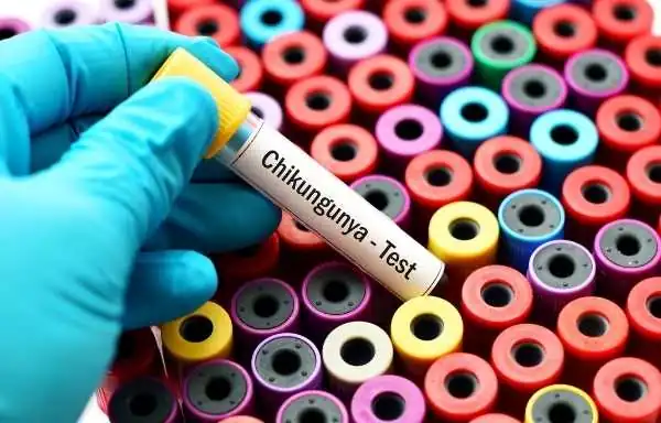 Prevention From Chikungunya In Hindi