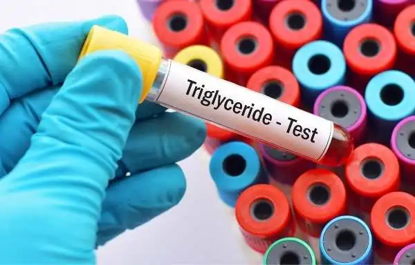high triglycerides and its Test in Hindi