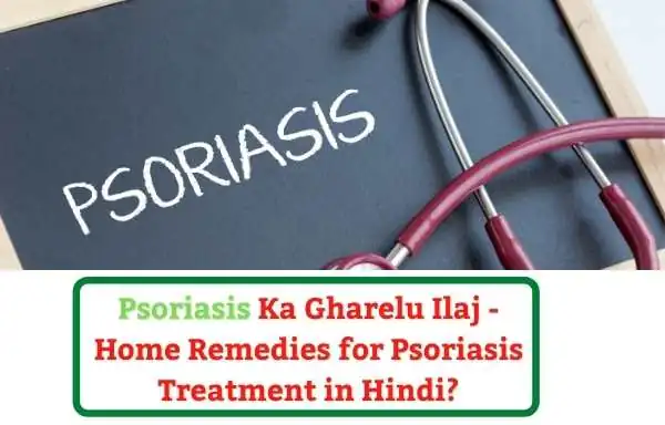 psoriasis treatment in Hindi | Psoriasis Ka Gharelu Ilaj - Home Remedies for Psoriasis Treatment in Hindi