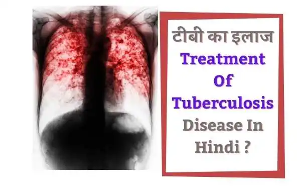 टीबी की बीमारी का परीक्षण कैसे होता है - Diagnosis and Treatment Of Tuberculosis In Hindi ?