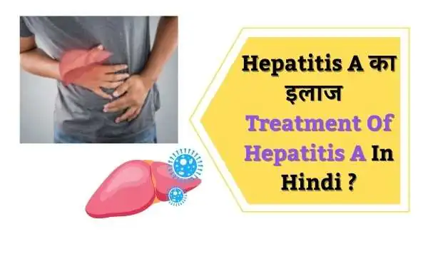 Hepatitis A Ka ilaj | Treatment Of Hapatitis A In Hindi?