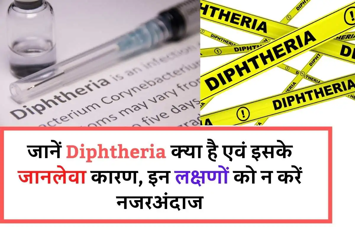 जानिए Diphtheria के लक्षण कारण एवं कारगर घरेलु उपचार |What is Diphtheria in Hindi know its symptoms, Causes, Prevention and best possible treatments