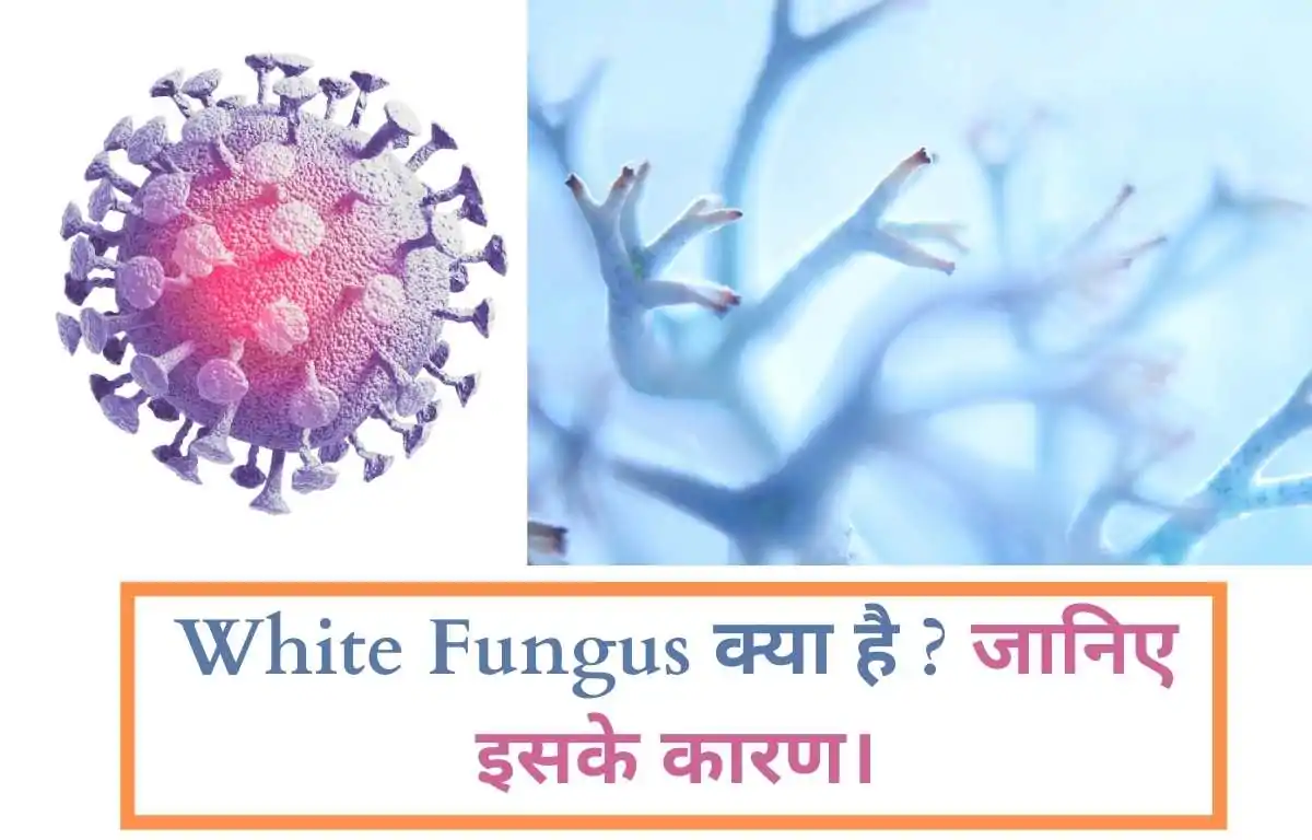 वाइट फंगस इंफेक्शन के क्या कारण है |  Causes Of White Fungus Infection In Hindi ?