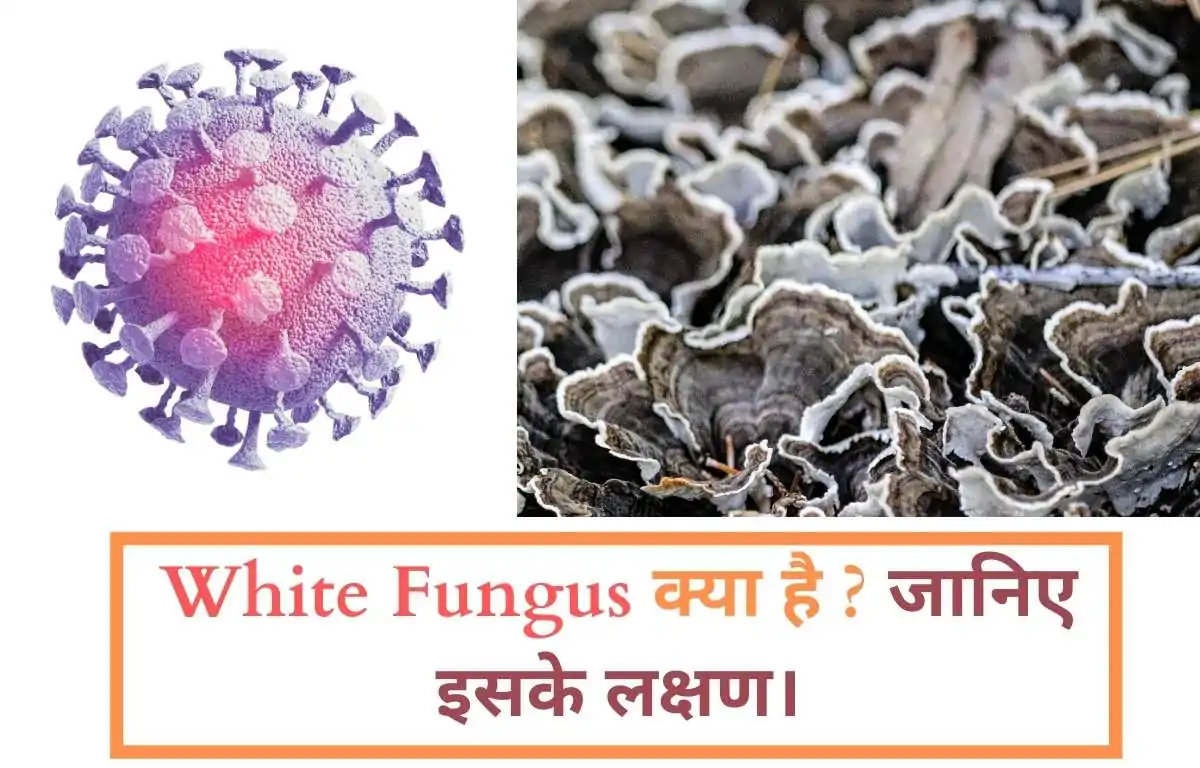 वाइट फंगस के लक्षण क्या है | Symptoms Of White Fungus In Hindi ?