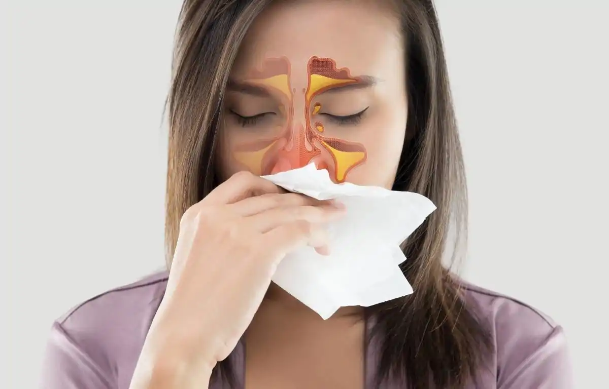 Sinus Infection या साइनस इन्फेक्शन क्या है ? इसके कारण , लक्षण , निदान , दवाएं , बचाव , सावधानियां ,इलाज और 12 घरेलु उपचार | What is Sinusitis or Sinus Infection ? Causes, symptoms, diagnosis, medicines, prevention, precautions, treatment and 12 home remedies.