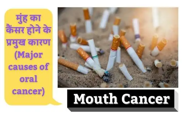 मुंह का कैंसर होने के प्रमुख कारण (Major causes of oral or Mouth cancer in Hindi)