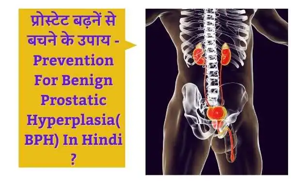 प्रोस्टेट बढ़नें के जोखिम कारक क्या है | Risk Factors Of Benign Prostatic Hyperplasia ( BPH ) In Hindi ?