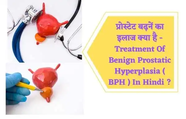 प्रोस्टेट बढ़नें का इलाज क्या है | Treatment Of Benign Prostatic Hyperplasia ( BPH ) In Hindi ?