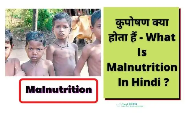  Malnutritished Children in the picture  
