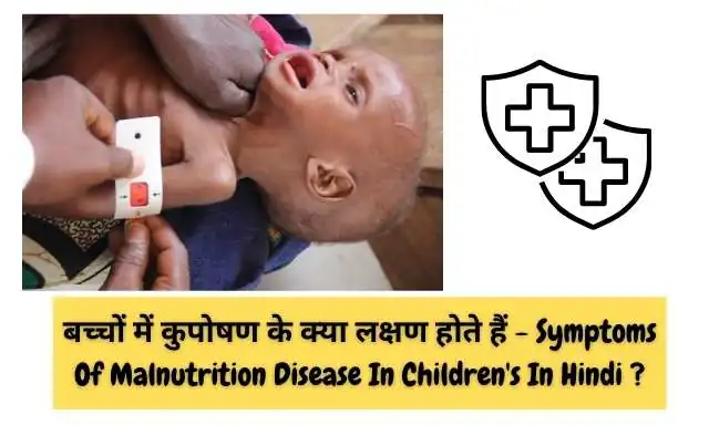 बच्चों में कुपोषण के क्या लक्षण होते हैं - Symptoms Of Malnutrition Disease In Children's Image