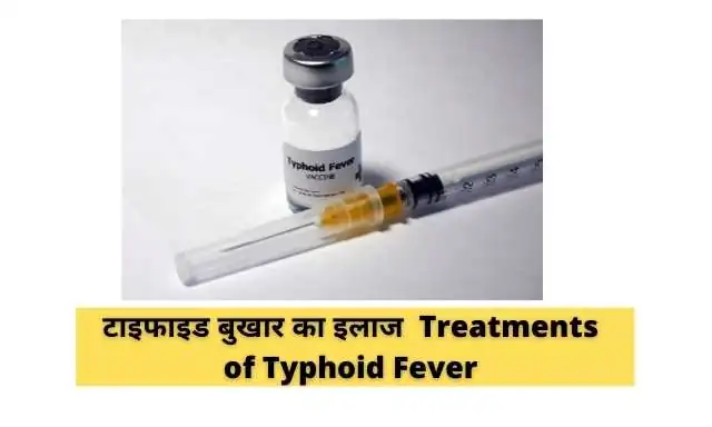 टाइफाइड बुखार का पता कैसे लगाया जाता है?|How is typhoid fever detected?