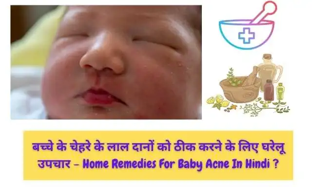 शिशु के चेहरे के दानों का इलाज - Treatment Of Baby Acne In Hindi ?