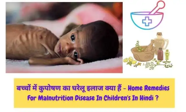 बच्चों में कुपोषण का उपचार - Treatment Of Malnutrition Disease In Children's Image 