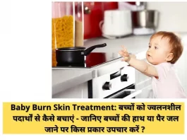 Baby Burn Skin Treatment